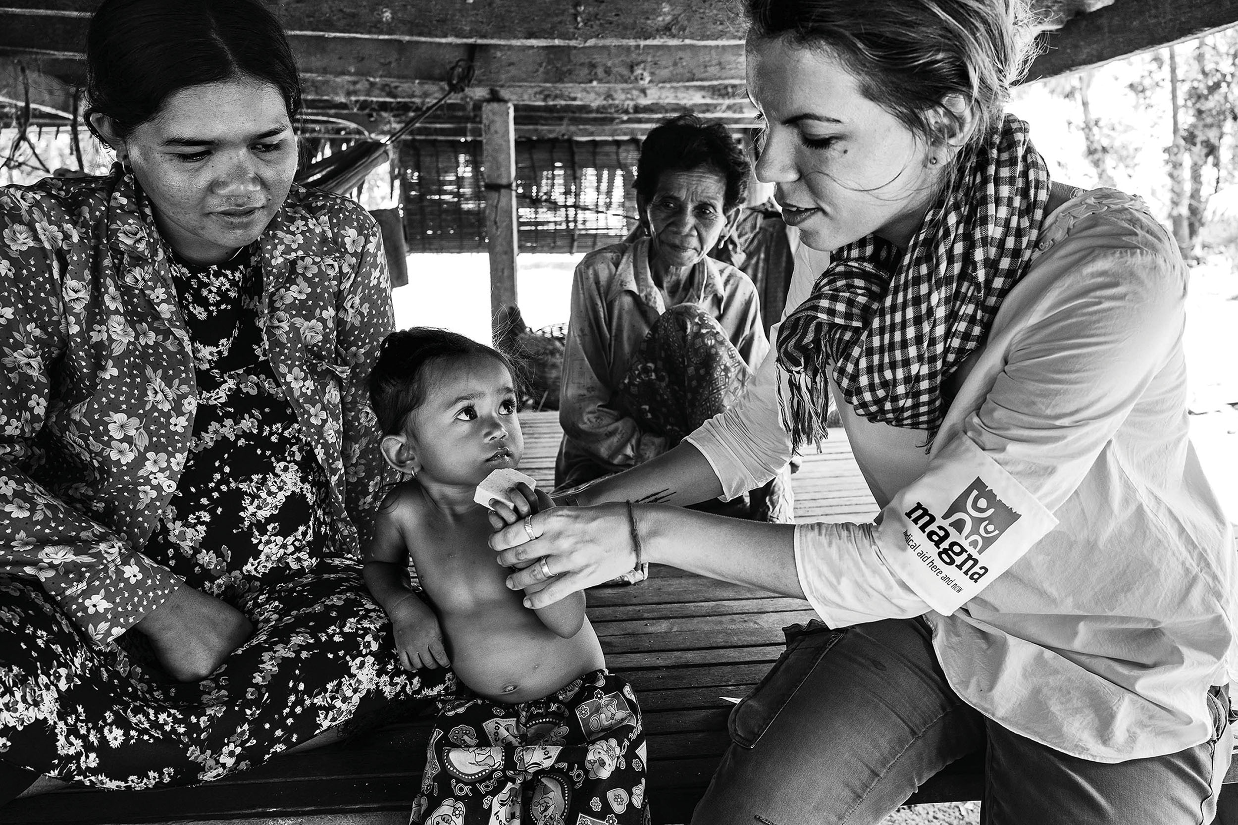 Podvyživené dítě v Kambodži. Více na www.magna.org.